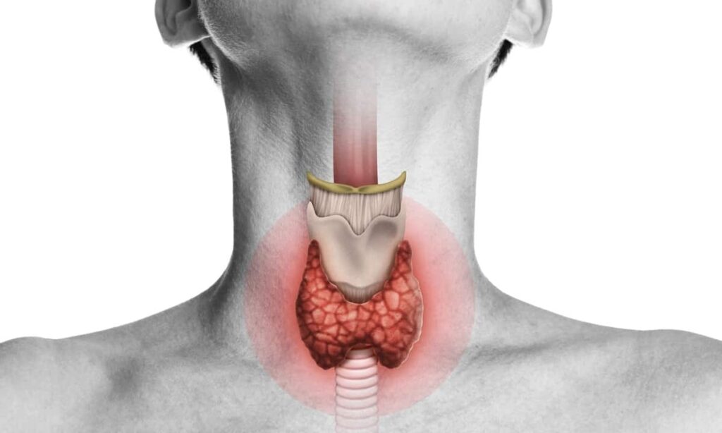 thyroid